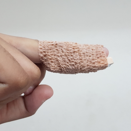 Mallet-Finger-Ozark-Physical-Therapy-Specialists-Mountain-Home-AR